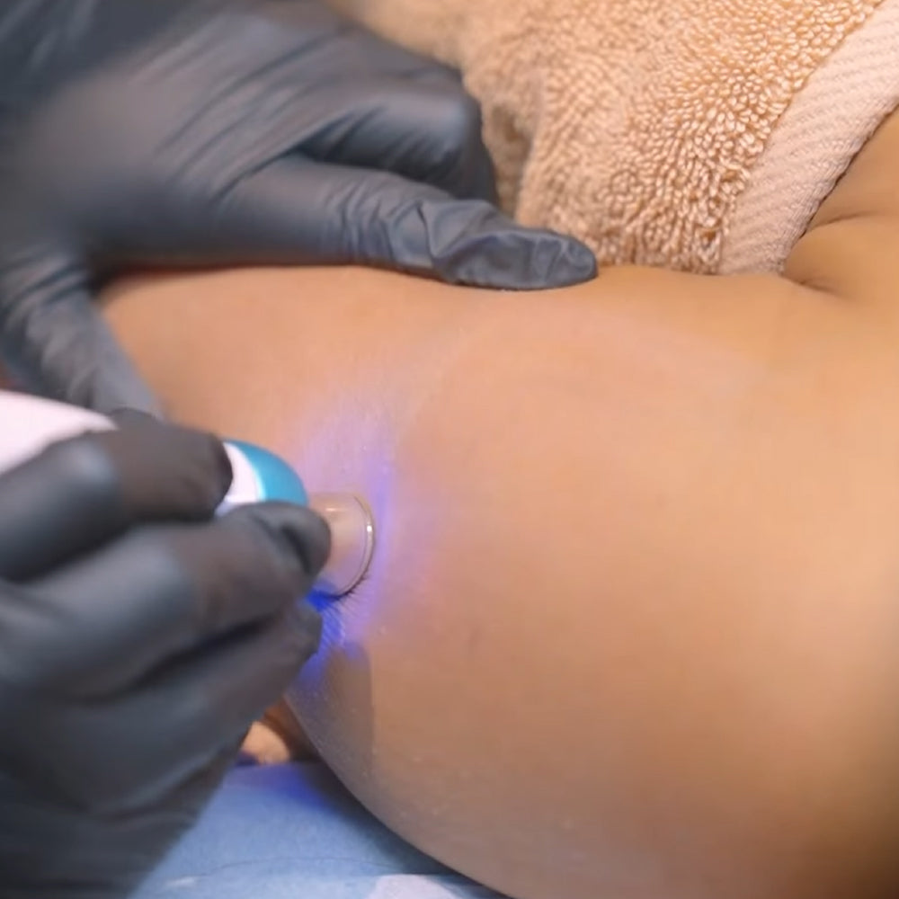 SKIN POLISHING